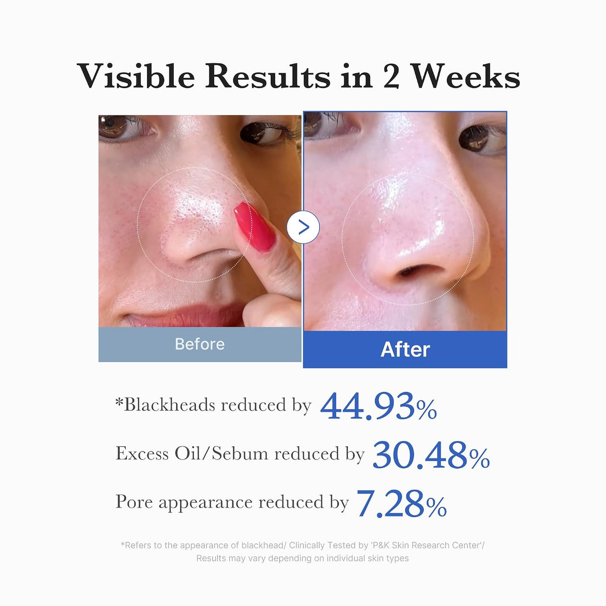 Medicube - Zero Pore Pads
