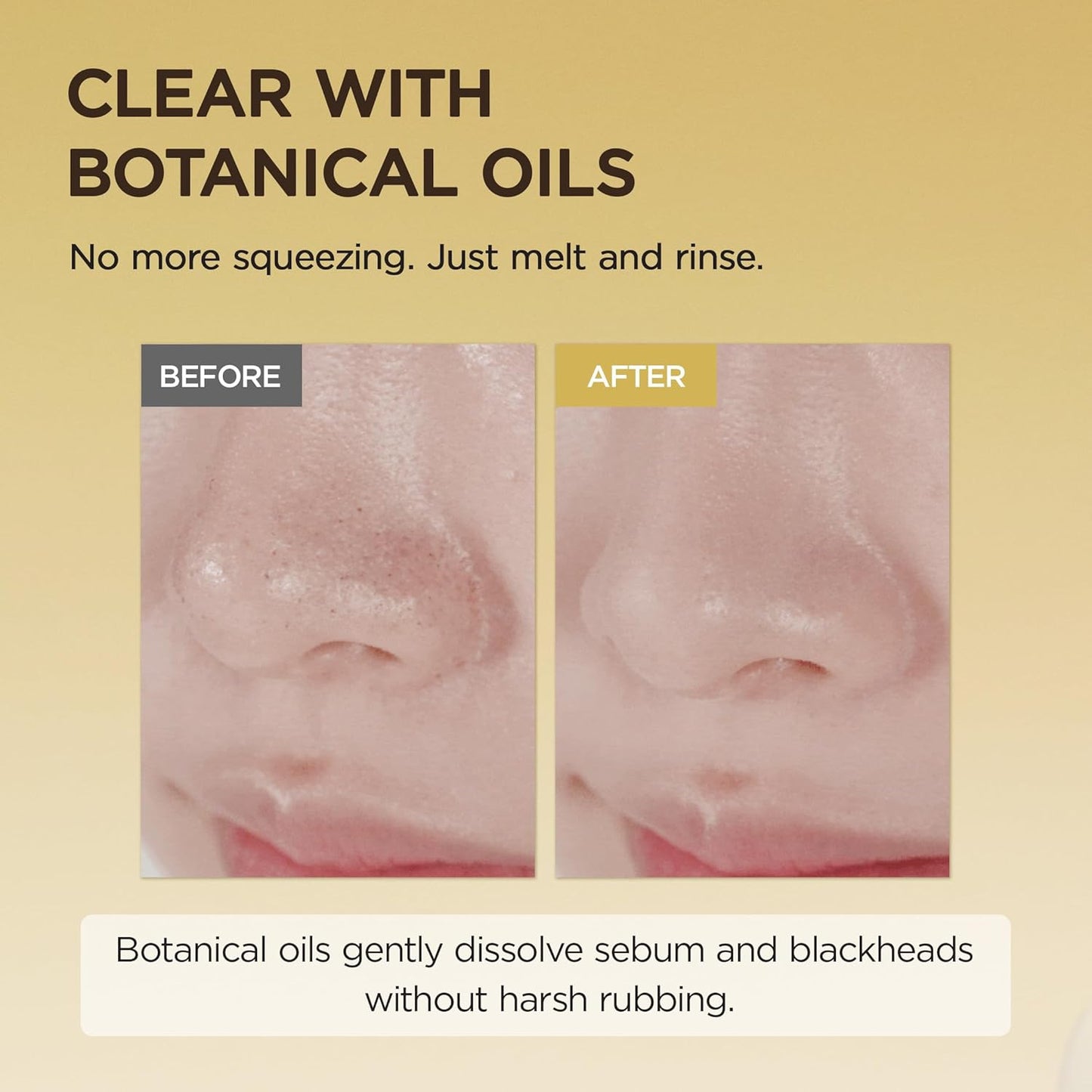 Centella - Skin 1004 - Aceite Limpiador