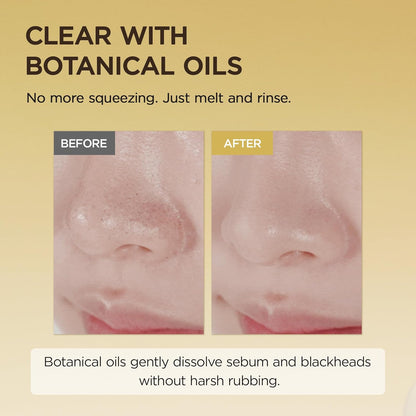 Skin 1004 - Light Cleansing Oil